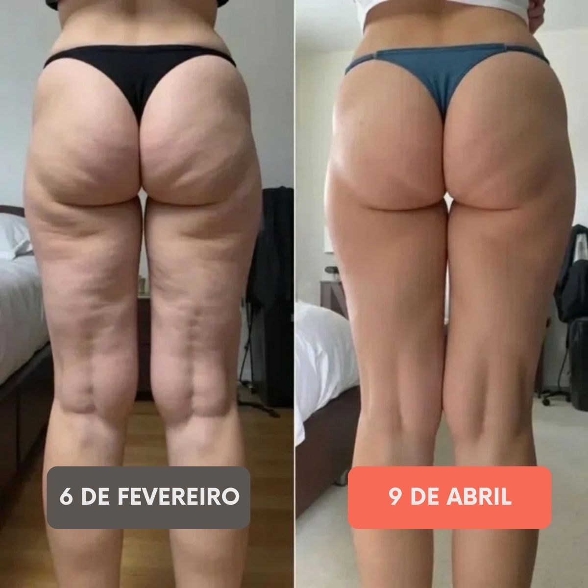 FITTABELLA SCULPT™ Legging Anticelulite 3D