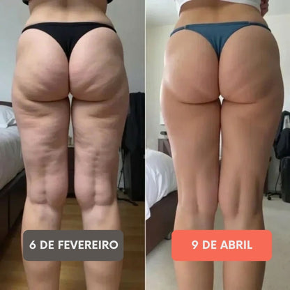 FITTABELLA SCULPT™ Legging Anticelulite 3D