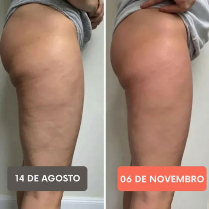 FITTABELLA SCULPT™ Legging Anticelulite 3D